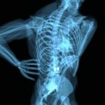 Best Stretches for Herniated Disc Recovery: Gentle Exercises for Pain Relief