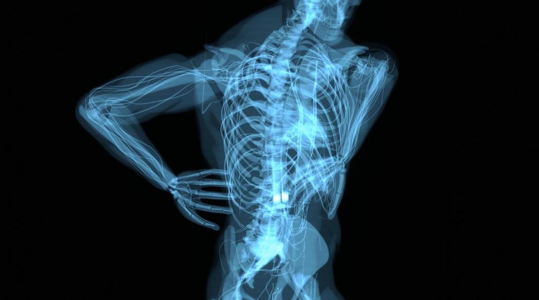 Best Stretches for Herniated Disc Recovery: Gentle Exercises for Pain Relief